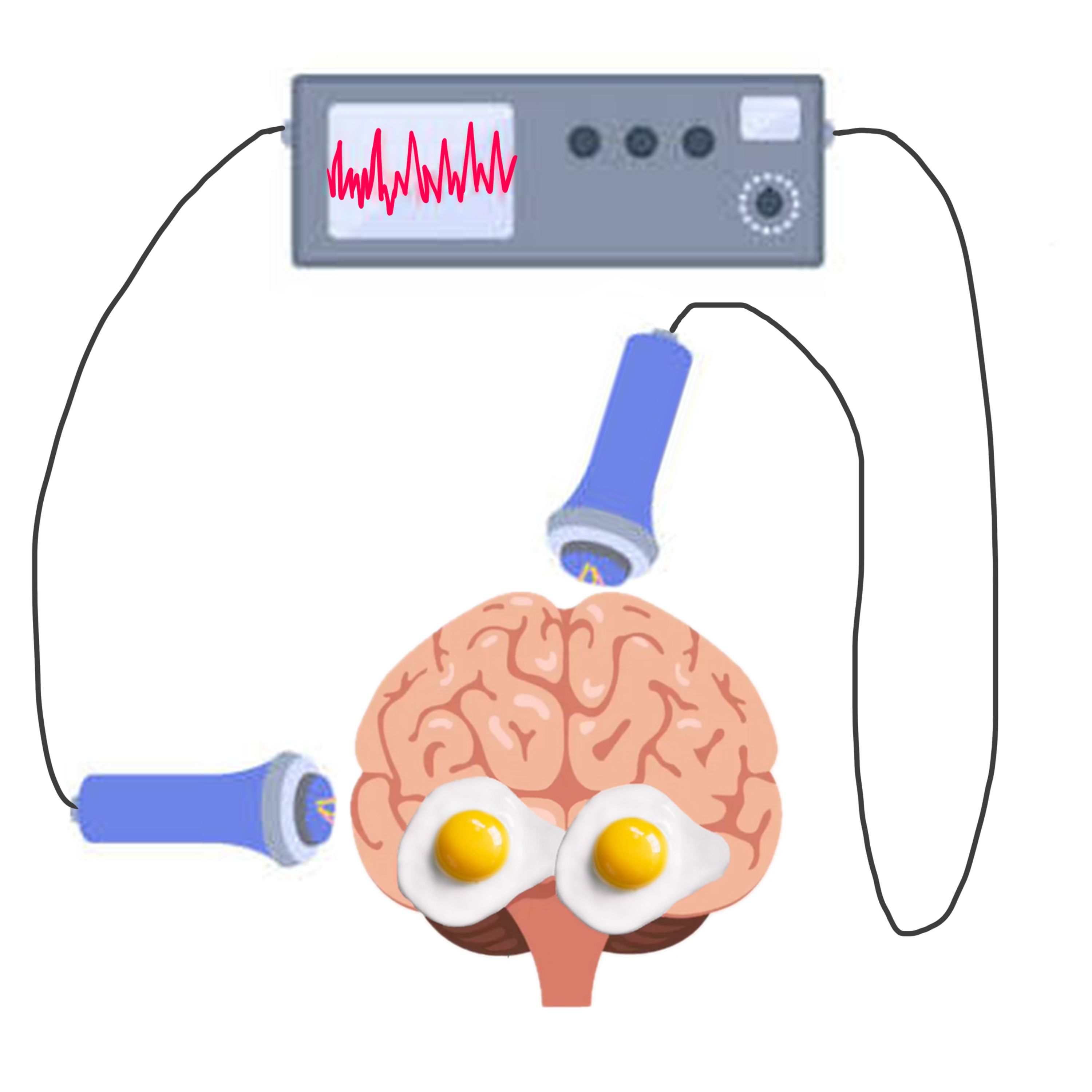 E50: Electroconvulsive Therapy: The Most Effective Psychiatric Treatment